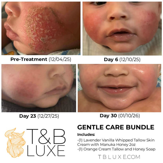 Gentle Care Bundle